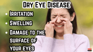 Dry Eye Awareness